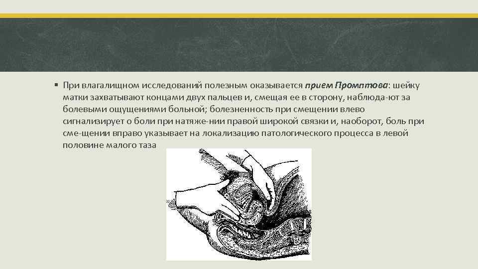 § При влагалищном исследований полезным оказывается прием Промптова: шейку матки захватывают концами двух пальцев