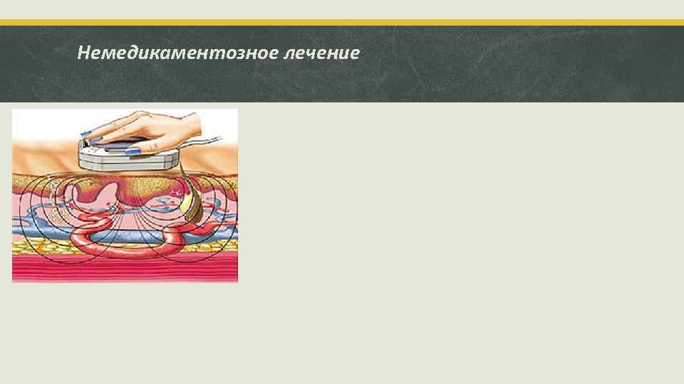 Немедикаментозное лечение 