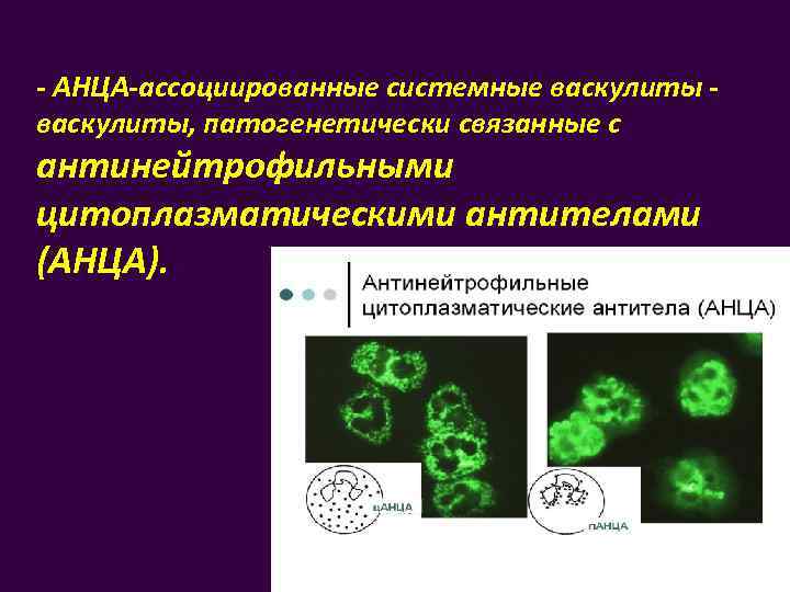 Системные васкулиты презентация терапия