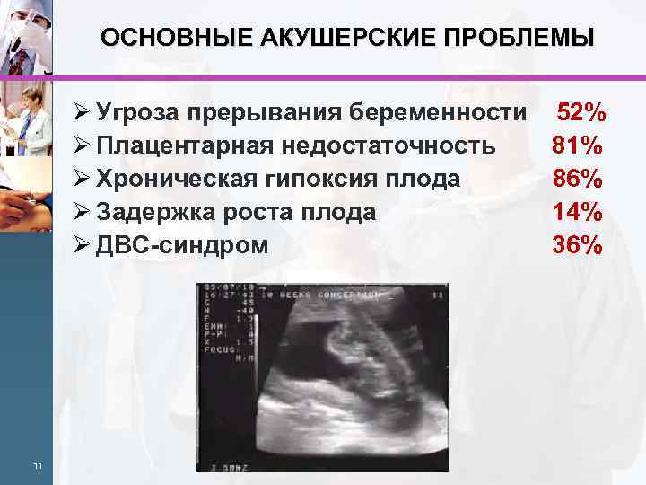 Угроза прерывания беременности карта - 86 фото