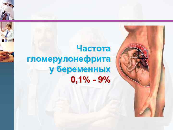 Частота гломерулонефрита у беременных 0, 1% - 9% 87 