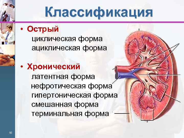 Классификация • Острый циклическая форма ациклическая форма • Хронический латентная форма нефротическая форма гипертоническая