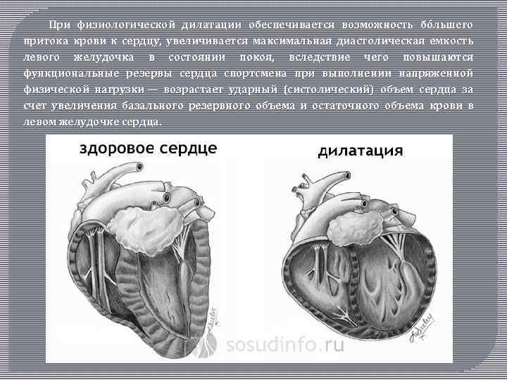 При физиологической дилатации обеспечивается возможность бóльшего притока крови к сердцу, увеличивается максимальная диастолическая емкость