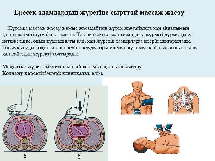 Ересек адамдардың жүрегіне сырттай массаж жасау Жүрекке массаж жасау жұмыс жасамайтын жүрек жағдайында кан