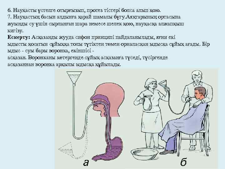 6. Науқасты үстелге отырғызып, протез тістері болса алып қою. 7. Науқастың басын алдынға қарай