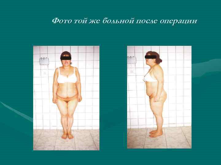Фото той же больной после операции 