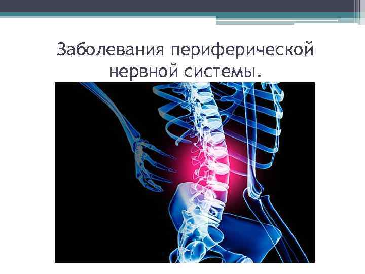 Заболевания периферической нервной системы. 