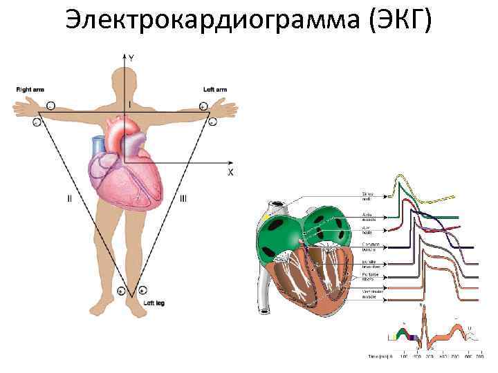 Электрокардиограмма (ЭКГ) 