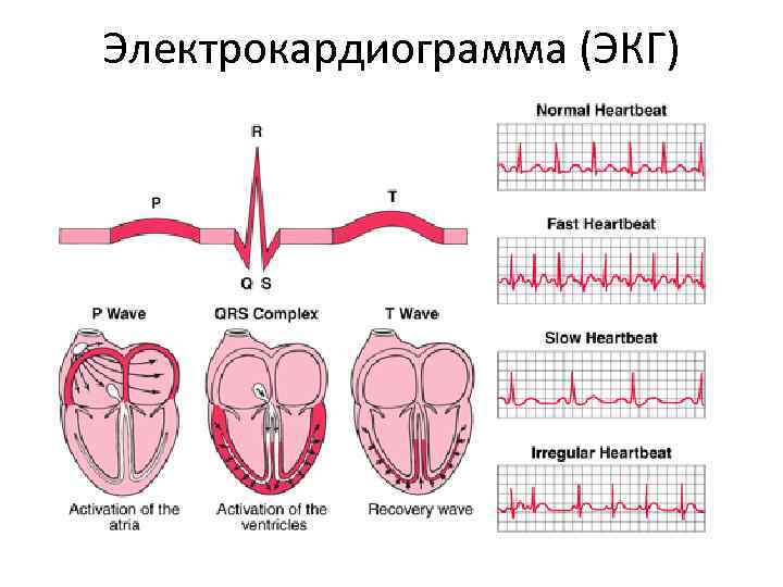 Электрокардиограмма (ЭКГ) 