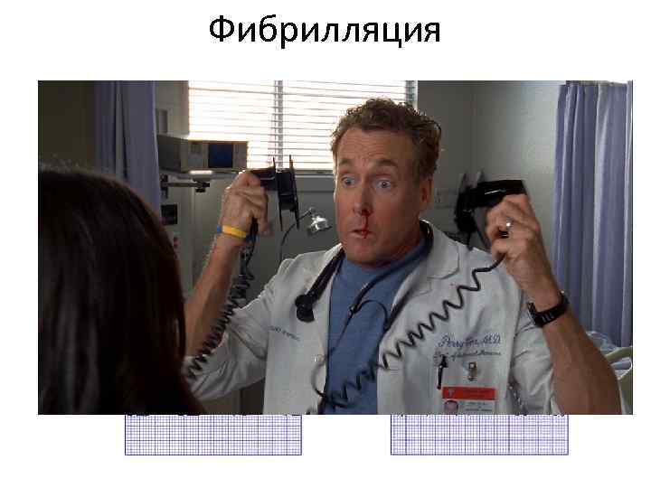 Фибрилляция 