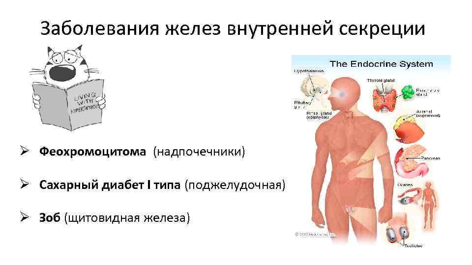 Заболевания желез внутренней секреции Ø Феохромоцитома (надпочечники) Ø Сахарный диабет I типа (поджелудочная) Ø
