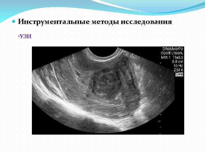  Инструментальные методы исследования • УЗИ 