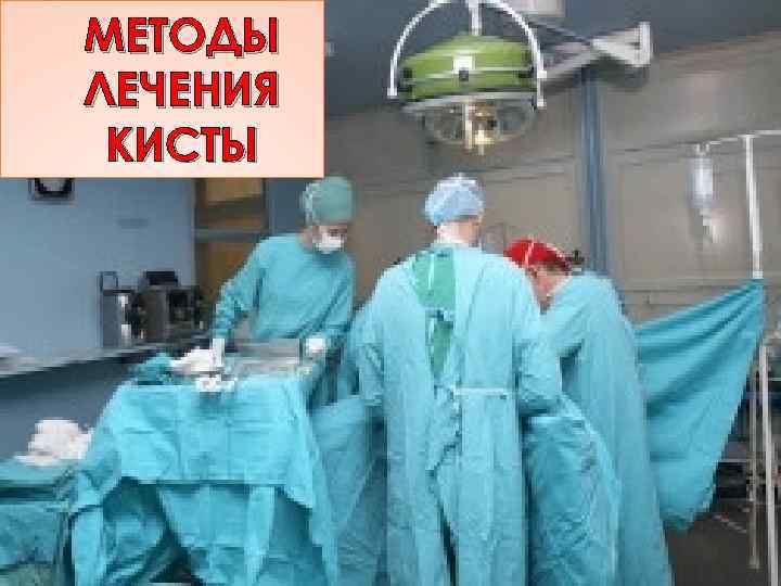 МЕТОДЫ ЛЕЧЕНИЯ КИСТЫ 