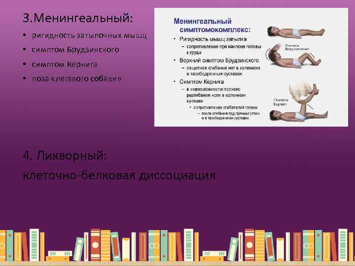 3. Менингеальный: • ригидность затылочных мышц • симптом Брудзинского • симптом Кернига • поза