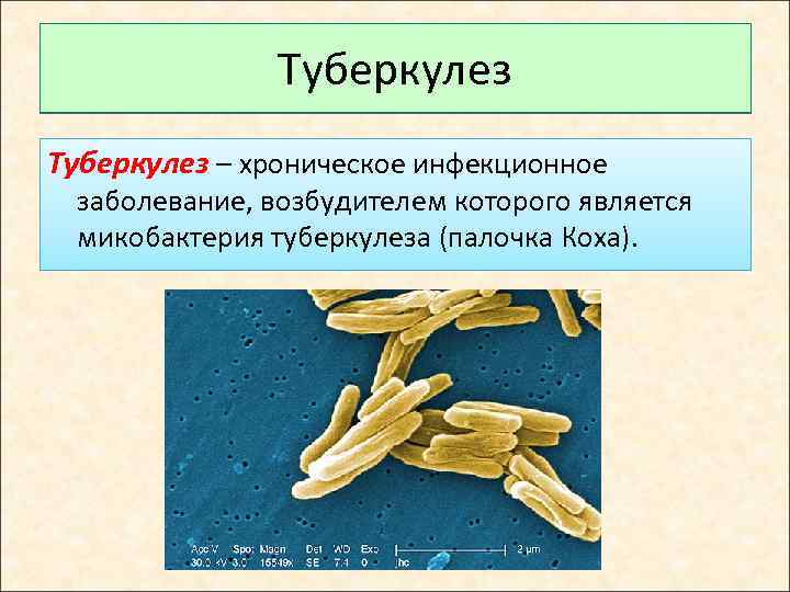 Туберкулез – хроническое инфекционное заболевание, возбудителем которого является микобактерия туберкулеза (палочка Коха). 