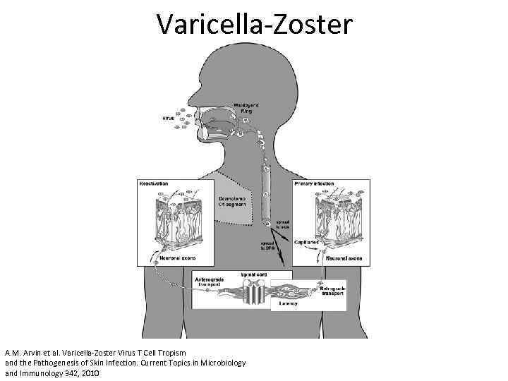 Varicella-Zoster A. M. Arvin et al. Varicella-Zoster Virus T Cell Tropism and the Pathogenesis