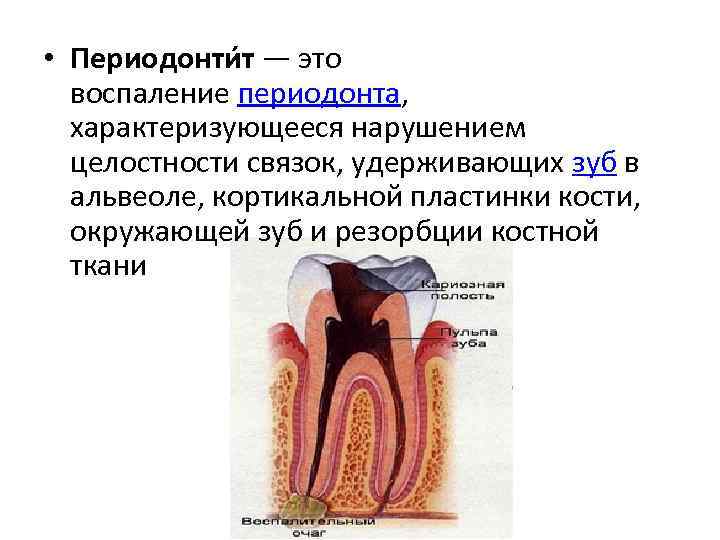 Форма острого периодонтита