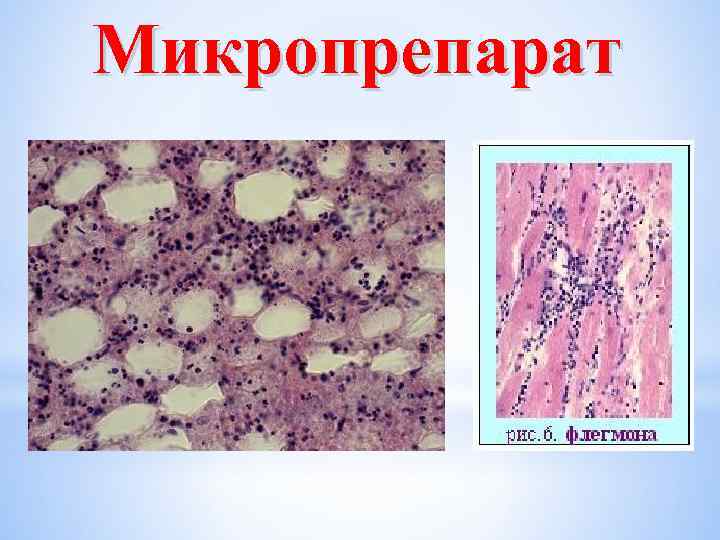 Микропрепарат 