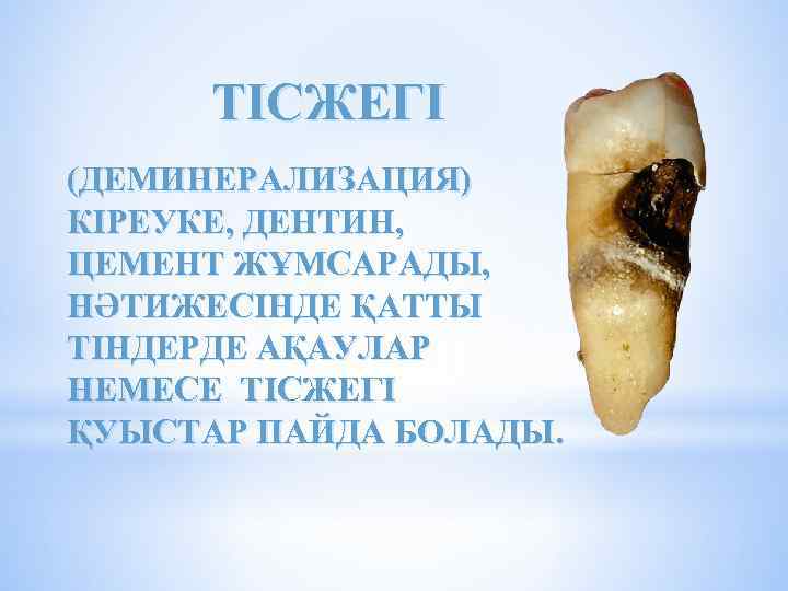 ТІСЖЕГІ (ДЕМИНЕРАЛИЗАЦИЯ) КІРЕУКЕ, ДЕНТИН, ЦЕМЕНТ ЖҰМСАРАДЫ, НӘТИЖЕСІНДЕ ҚАТТЫ ТІНДЕРДЕ АҚАУЛАР НЕМЕСЕ ТІСЖЕГІ ҚУЫСТАР ПАЙДА