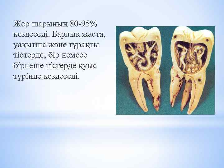 Жер шарының 80 -95% кездеседі. Барлық жаста, уақытша және тұрақты тістерде, бір немесе бірнеше