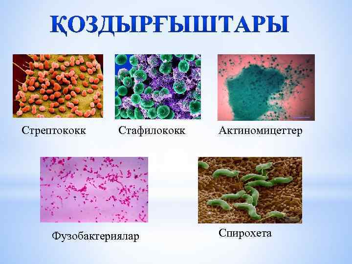 Стрептококк Стафилококк Фузобактериялар Актиномицеттер Спирохета 