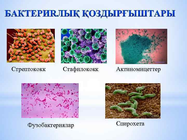 Стрептококк Стафилококк Фузобактериялар Актиномицеттер Спирохета 