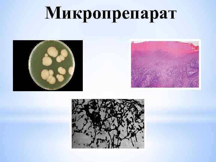 Микропрепарат 