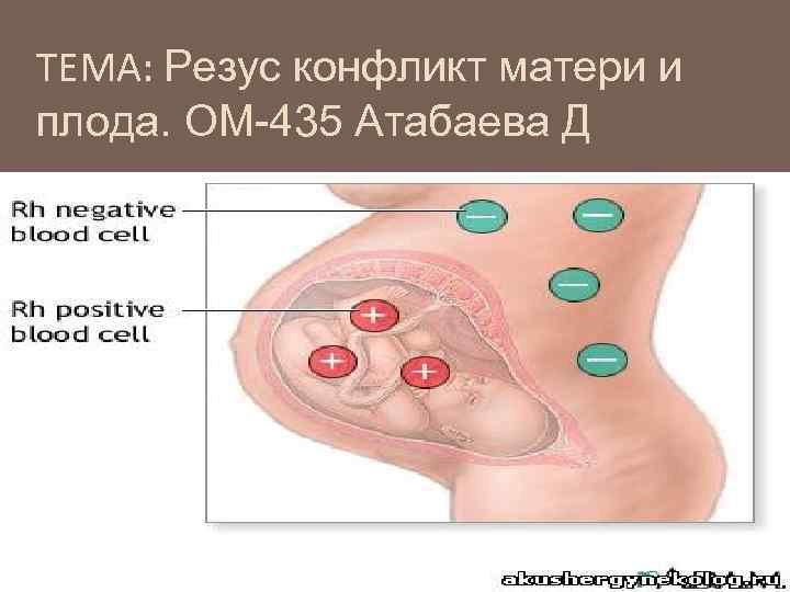 ТЕМА: Резус конфликт матери и плода. ОМ-435 Атабаева Д 