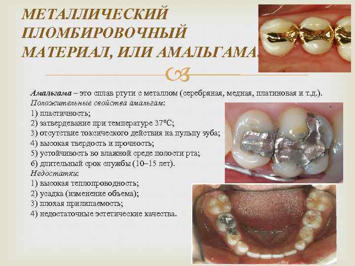 МЕТАЛЛИЧЕСКИЙ ПЛОМБИРОВОЧНЫЙ МАТЕРИАЛ, ИЛИ АМАЛЬГАМА. Амальгама – это сплав ртути с металлом (серебряная, медная,