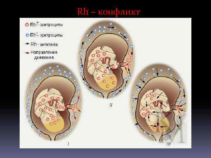 Rh – конфликт 