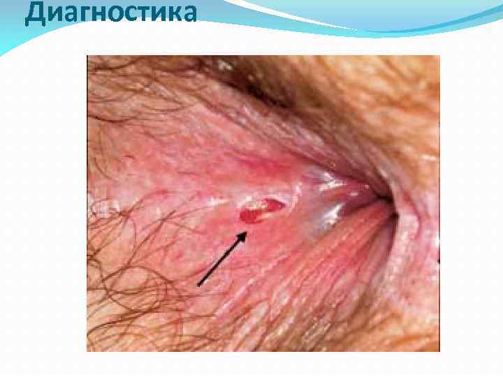 Диагностика 