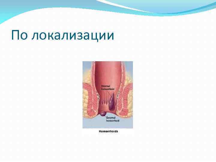 По локализации 