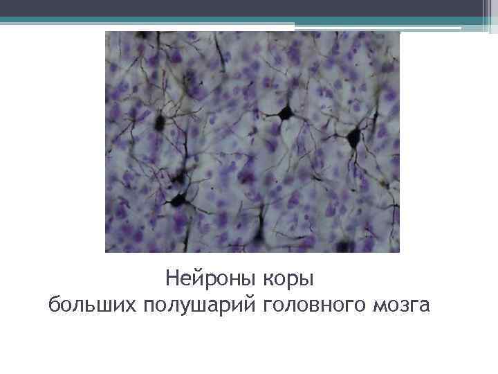 Нейроны коры больших полушарий головного мозга 