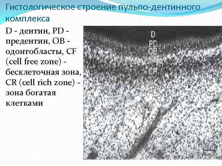 Гистологическое строение пульпо-дентинного комплекса D - дентин, PD предентин, OB одонтобласты, CF (cell free
