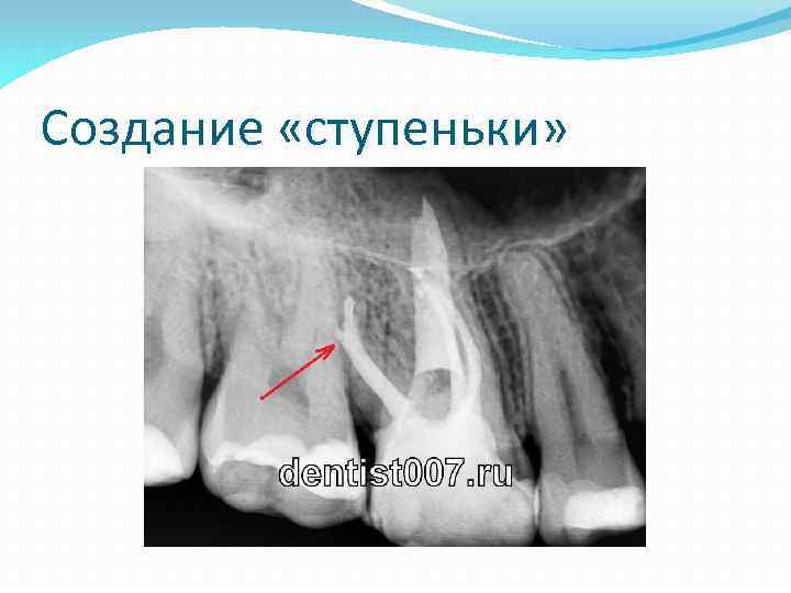 Создание «ступеньки» 