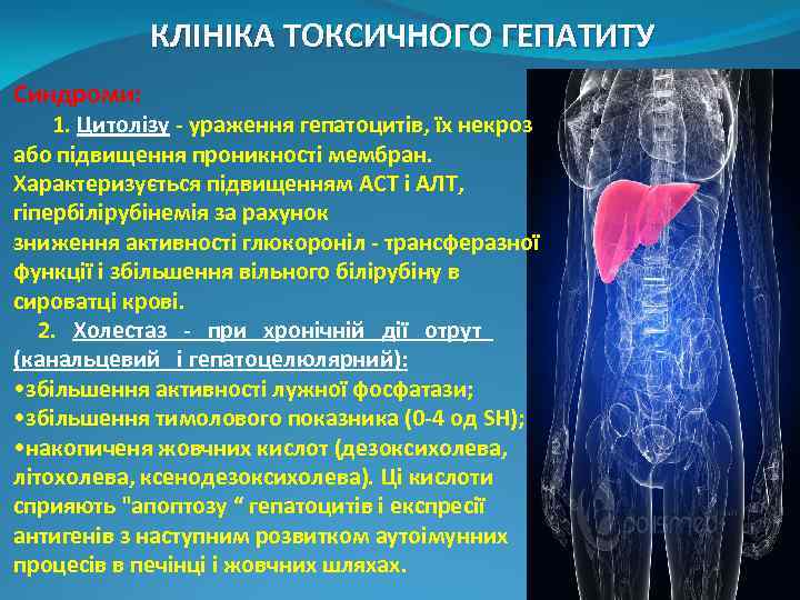 КЛІНІКА ТОКСИЧНОГО ГЕПАТИТУ Синдроми: 1. Цитолізу - ураження гепатоцитів, їх некроз або підвищення проникності