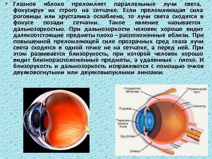 Фокусирует изображение на сетчатку это