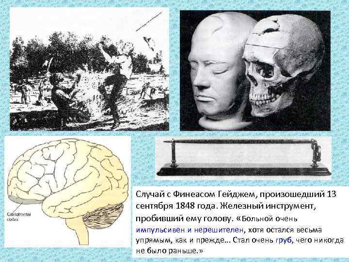 Случай с Финеасом Гейджем, произошедший 13 сентября 1848 года. Железный инструмент, пробивший ему голову.