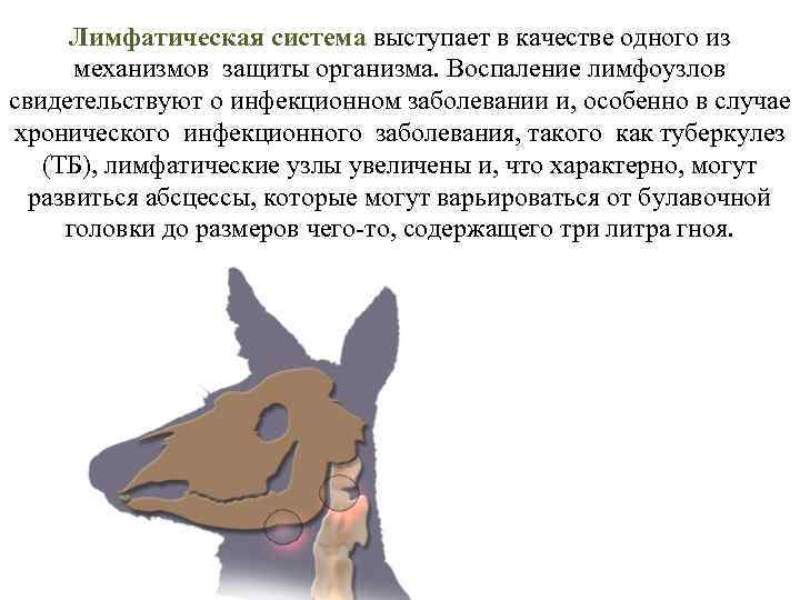 Лимфатическая система выступает в качестве одного из механизмов защиты организма. Воспаление лимфоузлов свидетельствуют о
