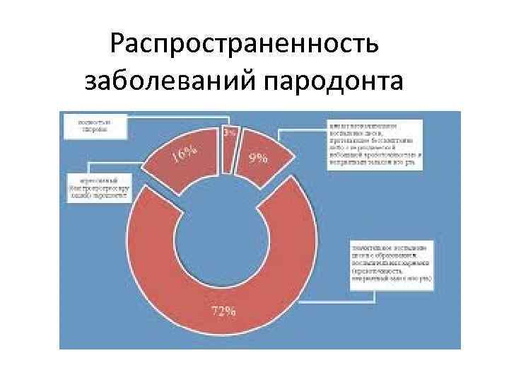 Распространенность заболеваний пародонта 