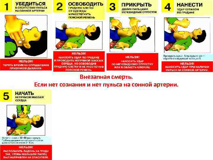 Внезапная смерть. Если нет сознания и нет пульса на сонной артерии. 