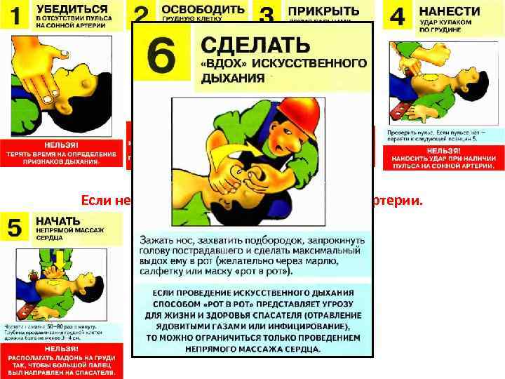 Внезапная смерть. Если нет сознания и нет пульса на сонной артерии. 