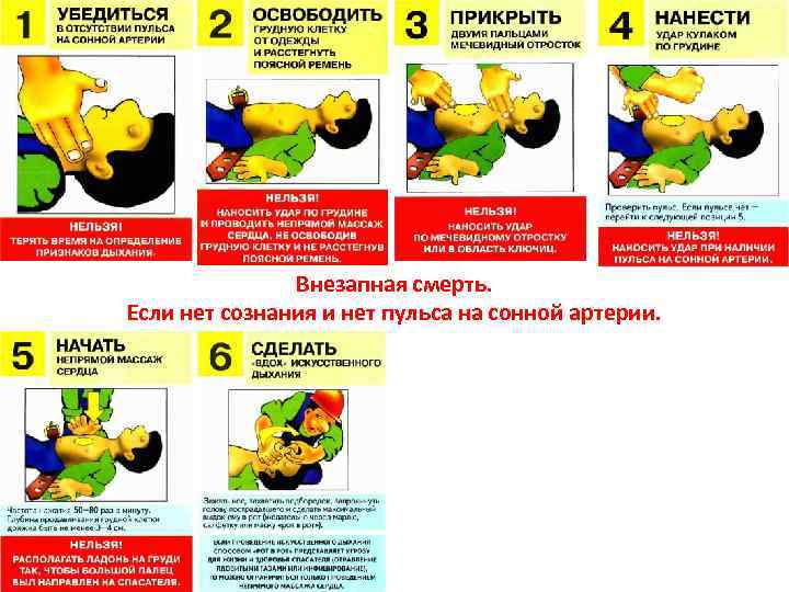 Внезапная смерть. Если нет сознания и нет пульса на сонной артерии. 
