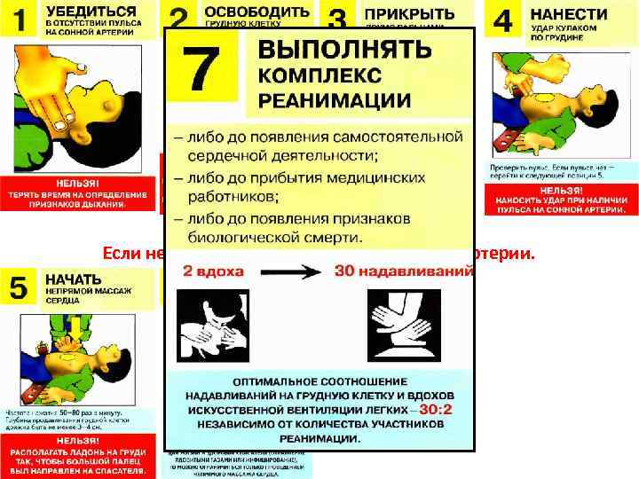 Внезапная смерть. Если нет сознания и нет пульса на сонной артерии. 