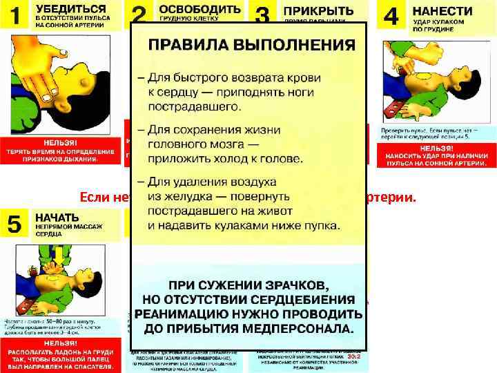 Внезапная смерть. Если нет сознания и нет пульса на сонной артерии. 