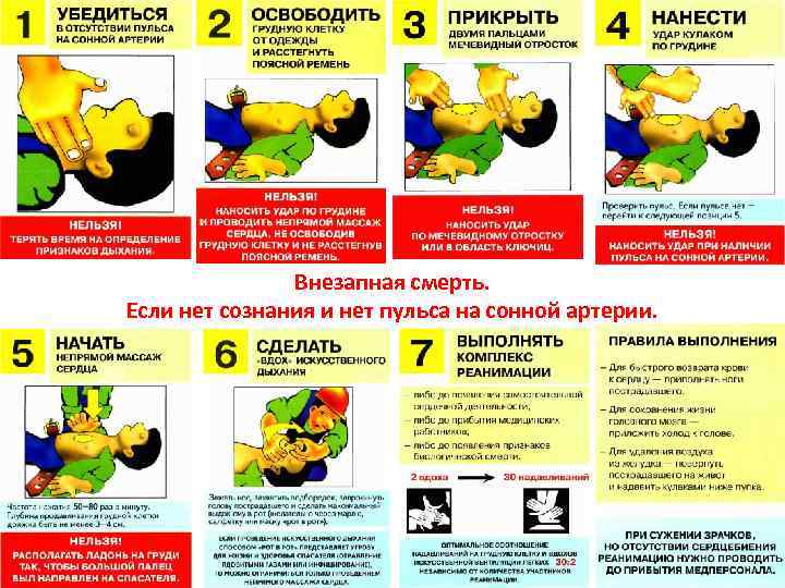 Внезапная смерть. Если нет сознания и нет пульса на сонной артерии. 