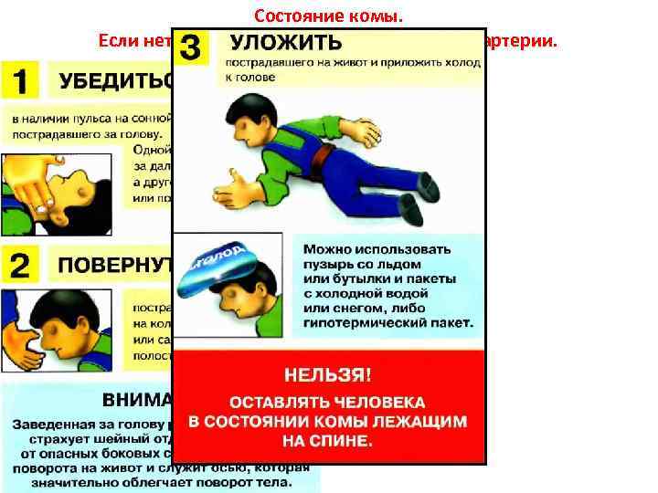 Состояние комы. Если нет сознания, но есть пульс на сонной артерии. 