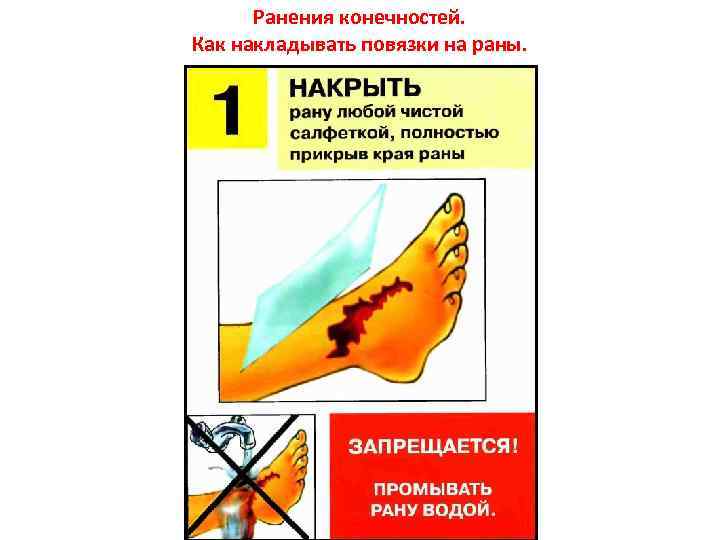 Ранения конечностей. Как накладывать повязки на раны. 
