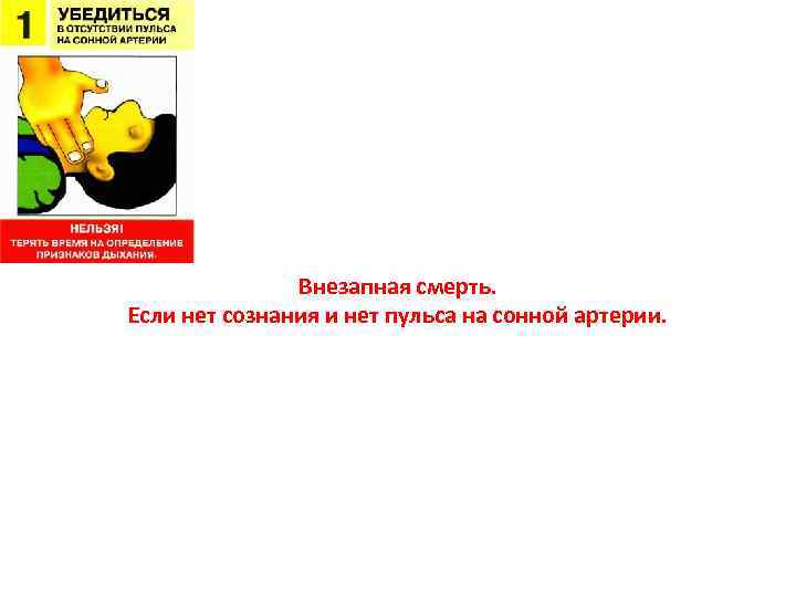 Внезапная смерть. Если нет сознания и нет пульса на сонной артерии. 