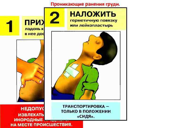 Проникающие ранения груди. Как накладывать повязки на раны. 